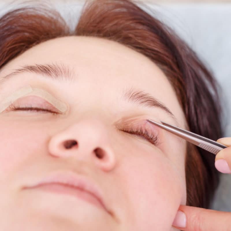 Cirugia-Facial02-blefaroplastia