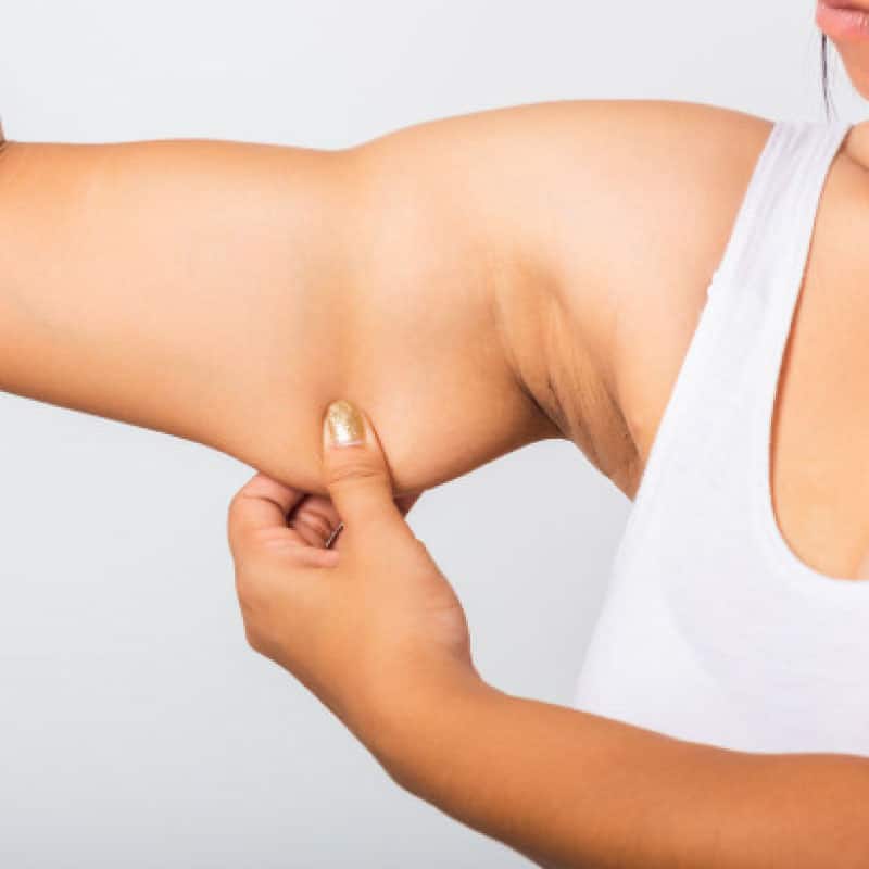 Contorno-Corporal03-Braquiplastia